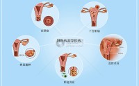 女性妇科疾病预防 (女性妇科疾病有哪几种)