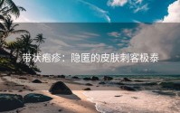 带状疱疹：隐匿的皮肤刺客极泰